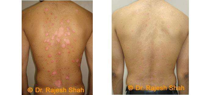 lifeforce homeopathy case-photos