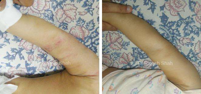 lifeforce homeopathy case-photos