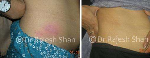 lifeforce homeopathy case-photos