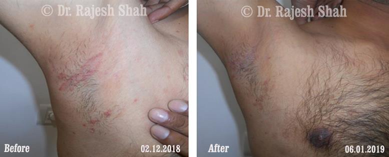 lifeforce homeopathy case-photos