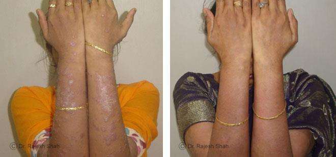 lifeforce homeopathy case-photos