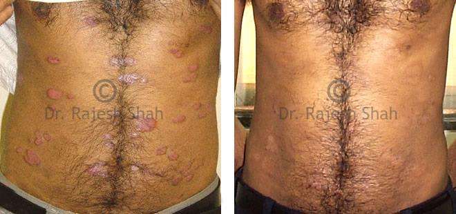 lifeforce homeopathy case-photos