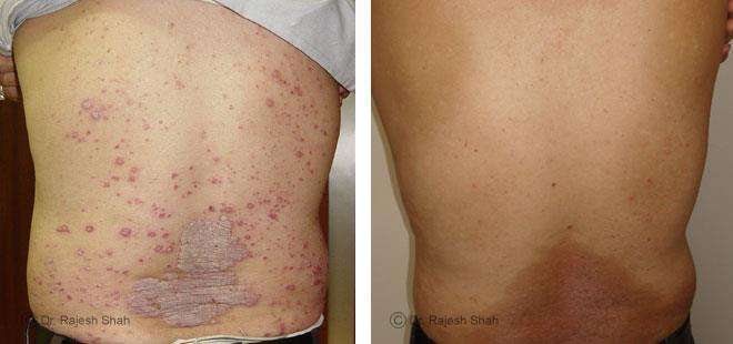 lifeforce homeopathy case-photos