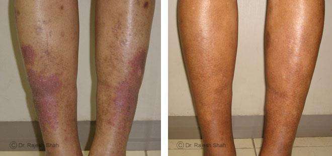lifeforce homeopathy case-photos