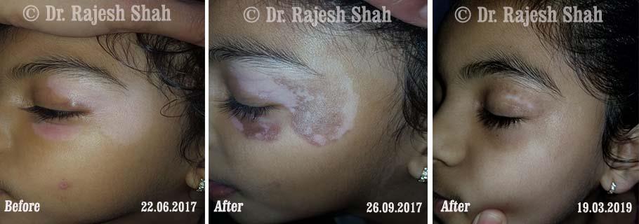 lifeforce homeopathy case-photos