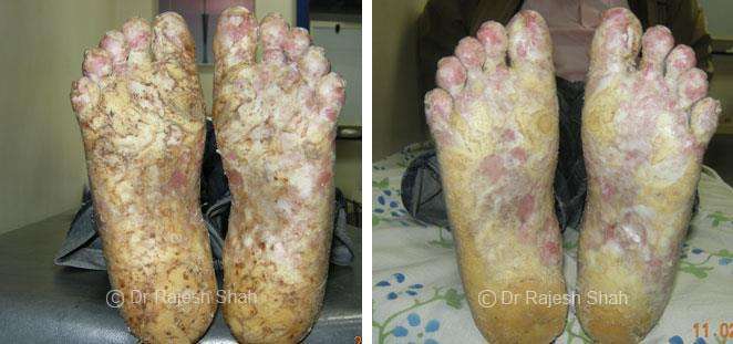 lifeforce homeopathy case-photos