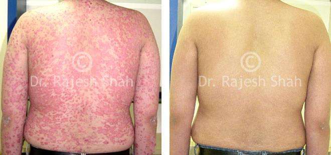 lifeforce homeopathy case-photos
