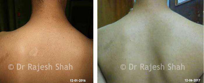 lifeforce homeopathy case-photos