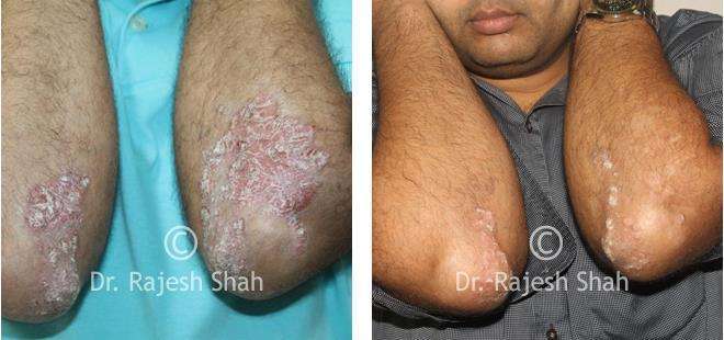 lifeforce homeopathy case-photos