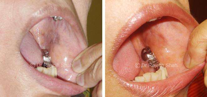 lifeforce homeopathy case-photos