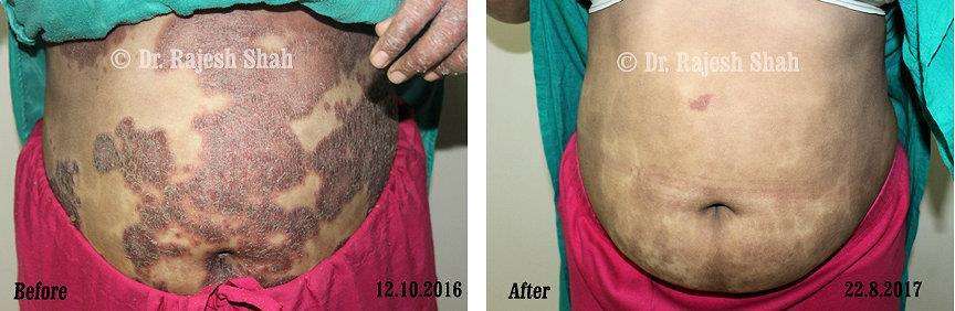 lifeforce homeopathy case-photos