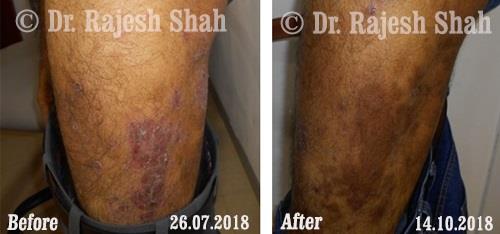 lifeforce homeopathy case-photos
