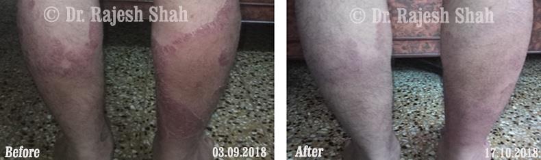 lifeforce homeopathy case-photos