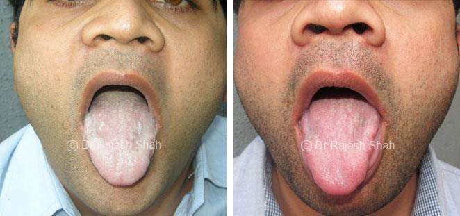 lifeforce homeopathy case-photos