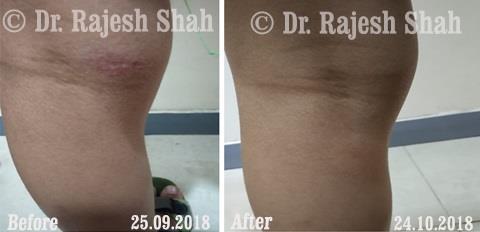 lifeforce homeopathy case-photos