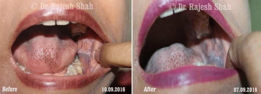 lifeforce homeopathy case-photos