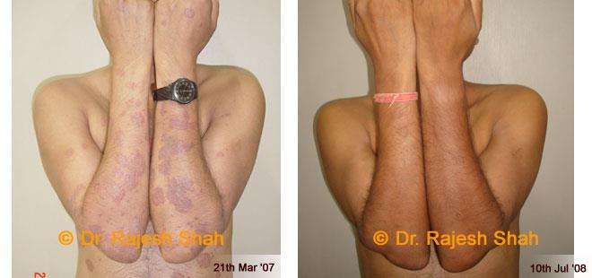 lifeforce homeopathy case-photos