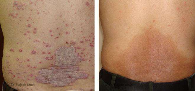 lifeforce homeopathy case-photos