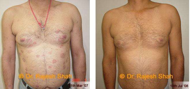 lifeforce homeopathy case-photos