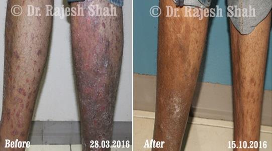 lifeforce homeopathy case-photos