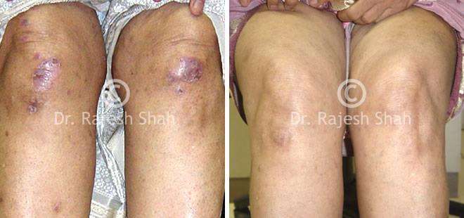 lifeforce homeopathy case-photos