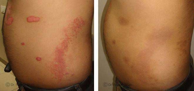 lifeforce homeopathy case-photos