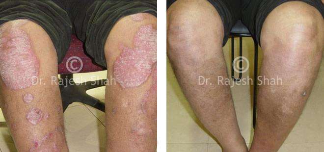 lifeforce homeopathy case-photos