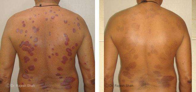 lifeforce homeopathy case-photos