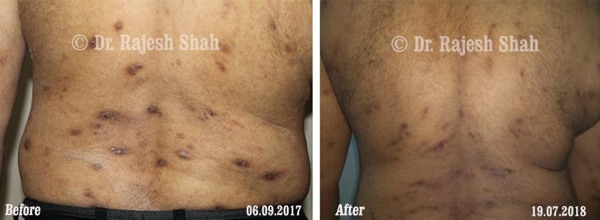 lifeforce homeopathy case-photos
