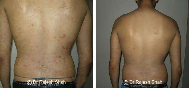 lifeforce homeopathy case-photos