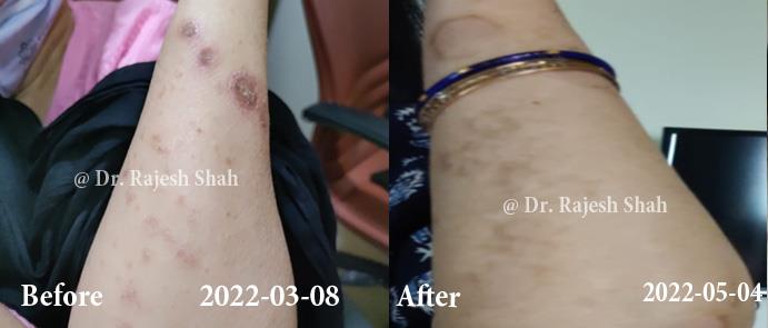 lifeforce homeopathy case-photos
