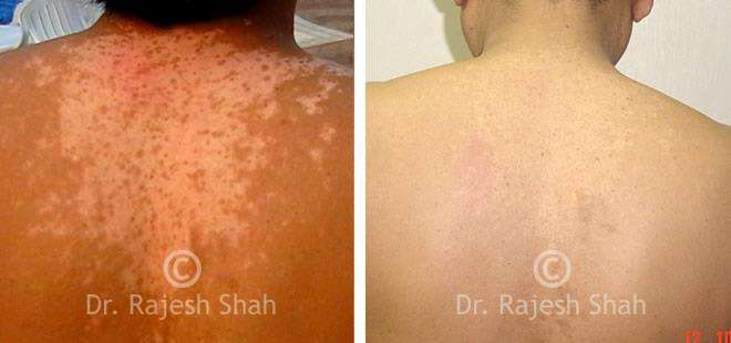 lifeforce homeopathy case-photos