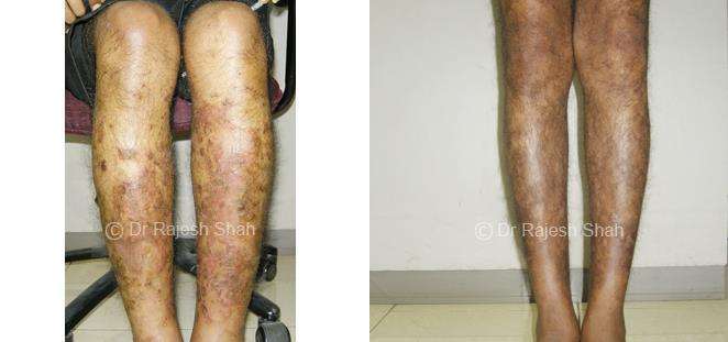 lifeforce homeopathy case-photos