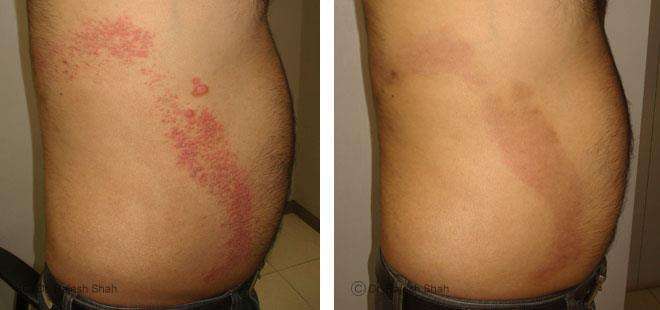lifeforce homeopathy case-photos