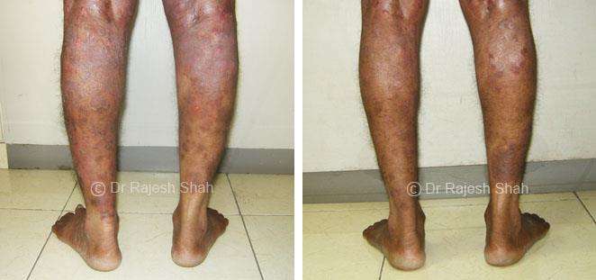 lifeforce homeopathy case-photos