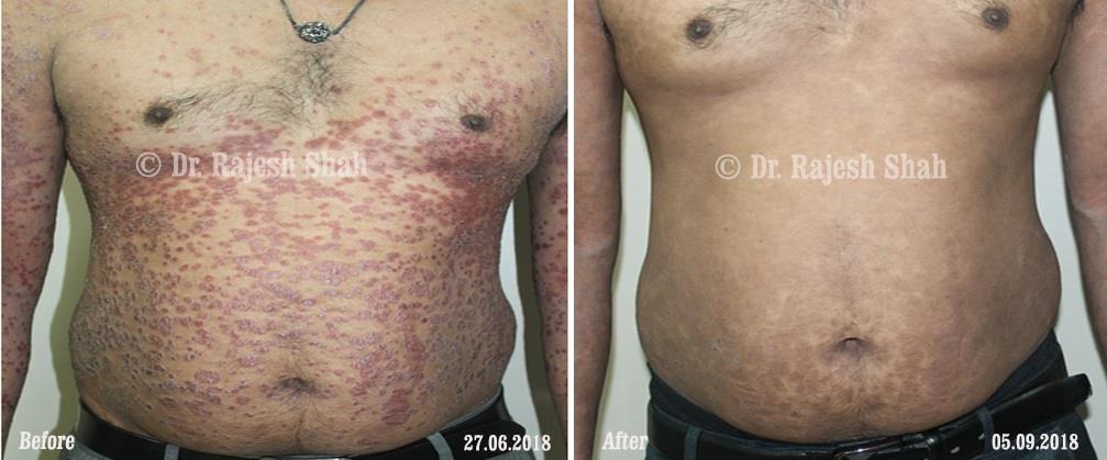 lifeforce homeopathy case-photos