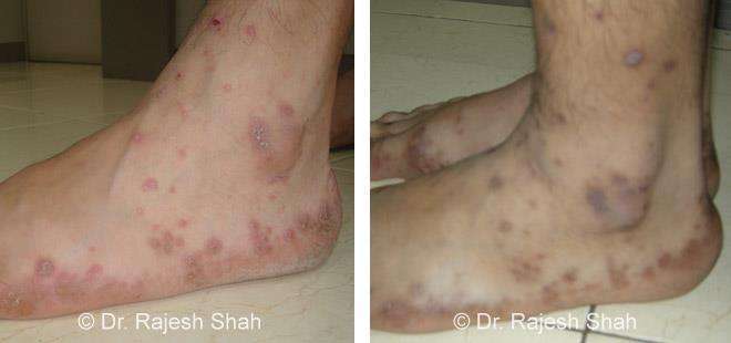 lifeforce homeopathy case-photos