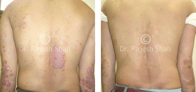 lifeforce homeopathy case-photos