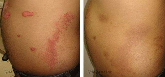lifeforce homeopathy case-photos