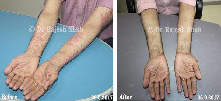 lifeforce homeopathy case-photos