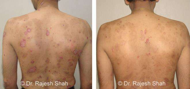 lifeforce homeopathy case-photos