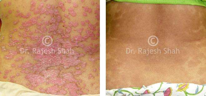 lifeforce homeopathy case-photos