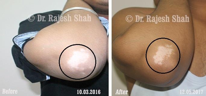 lifeforce homeopathy case-photos