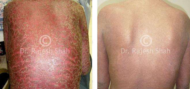 lifeforce homeopathy case-photos
