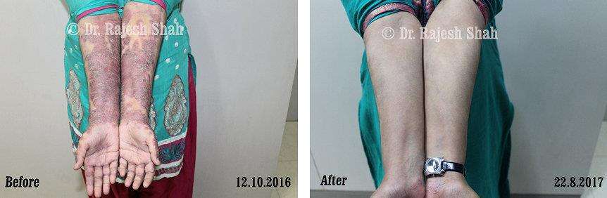 lifeforce homeopathy case-photos