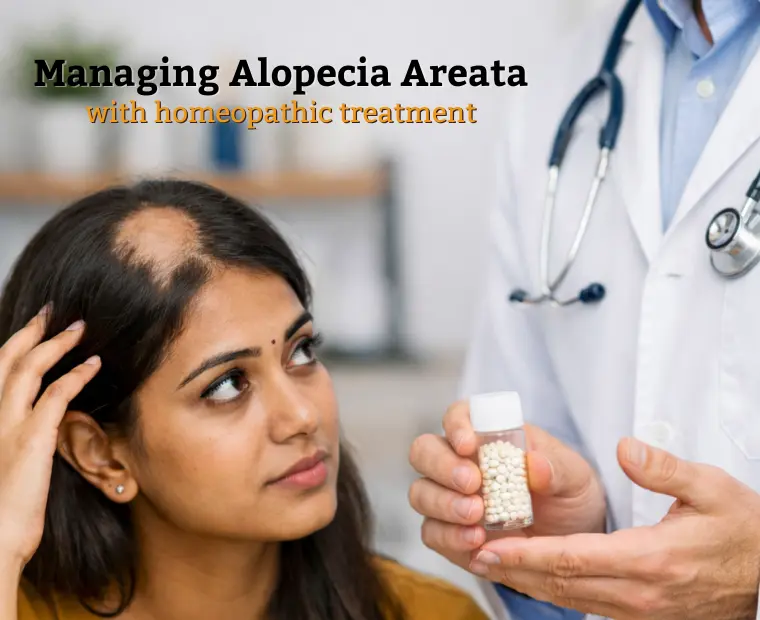 Managing Alopecia Areata