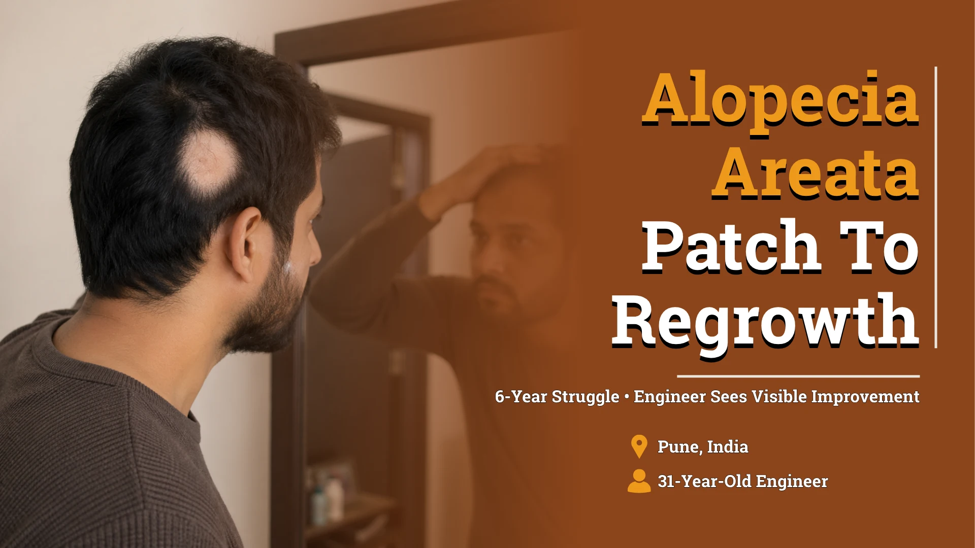 From Bald Patch to Hair Regrowth: A Real Case of Alopecia Areata Homeopathic Treatment