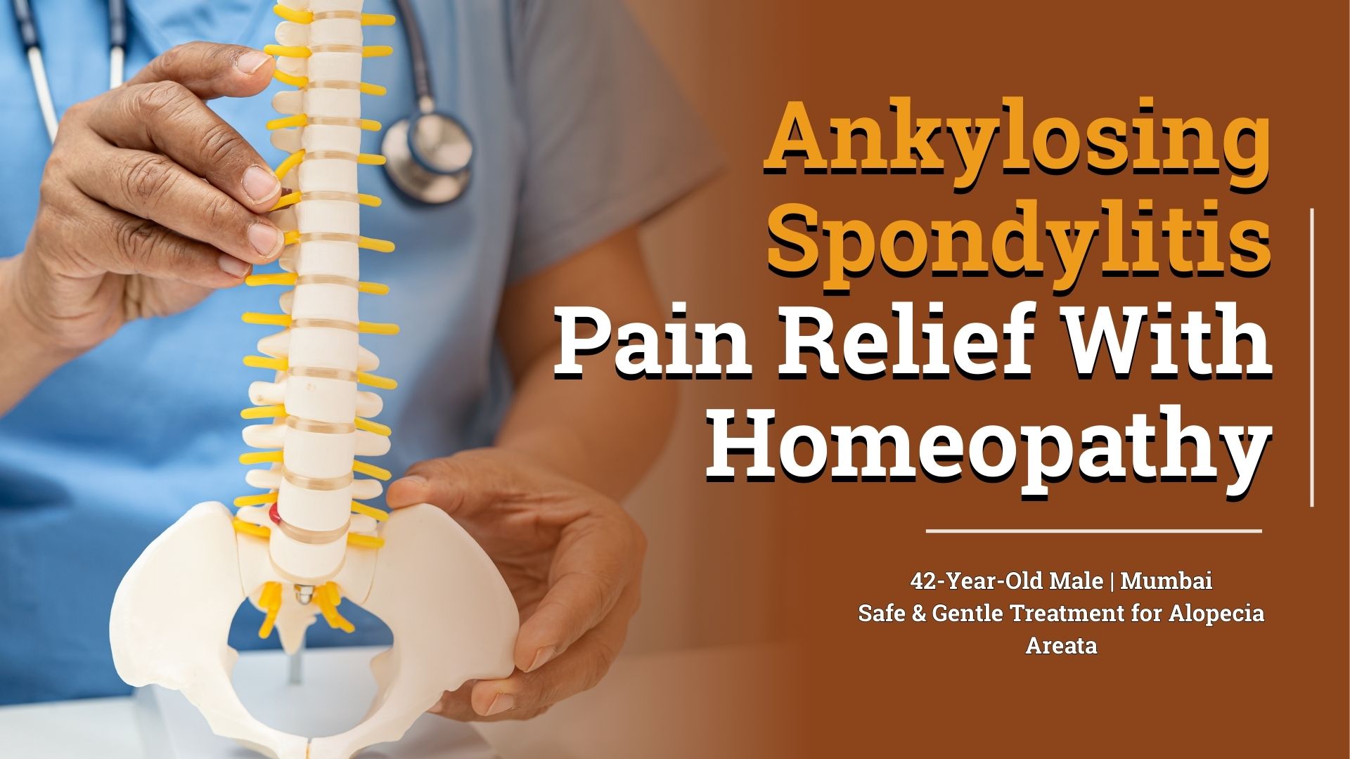 Ankylosing Spondylitis Pain Relief With Homeopathy 16991