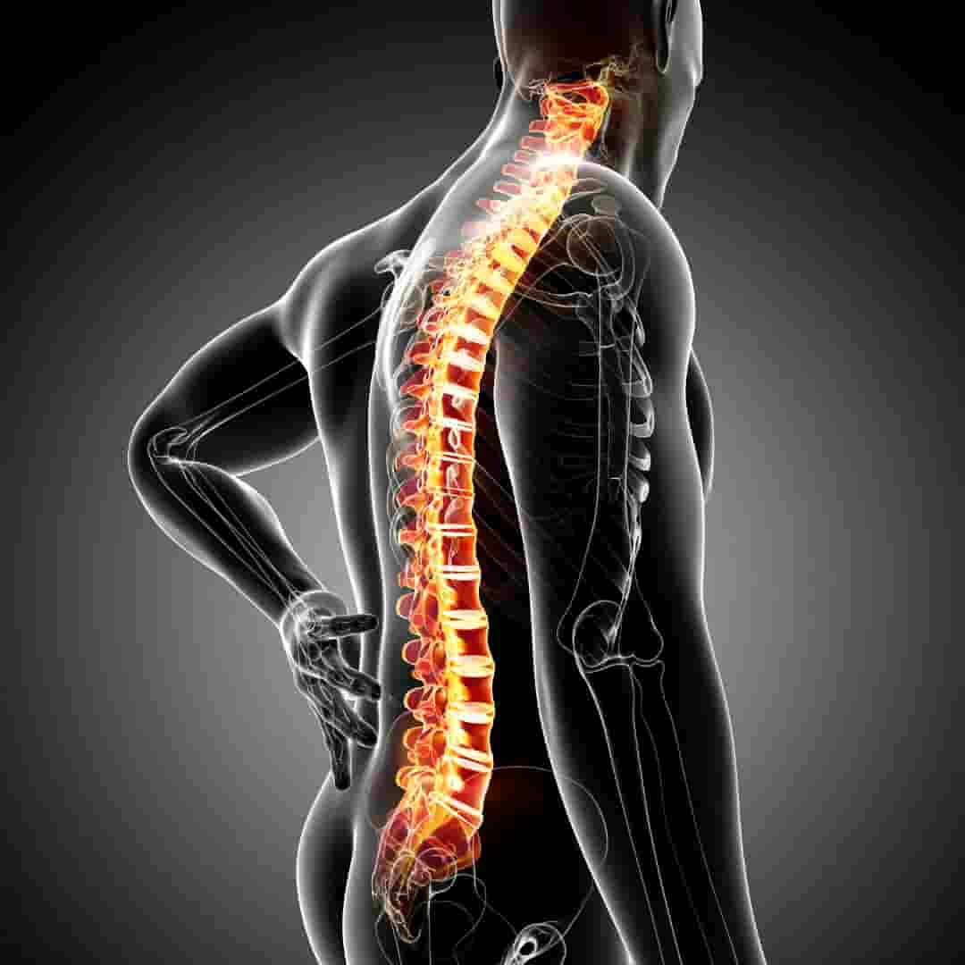 Ankylosing Spondylitis