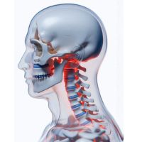 Cervical Disc Degeneration
